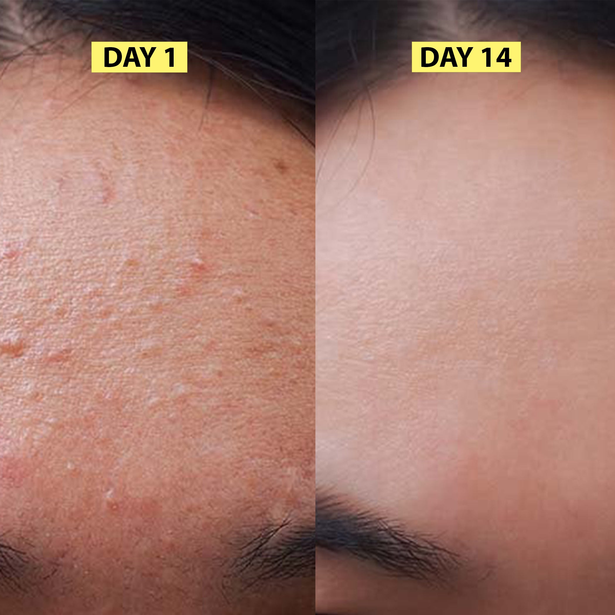 Nail Growth Oil Results